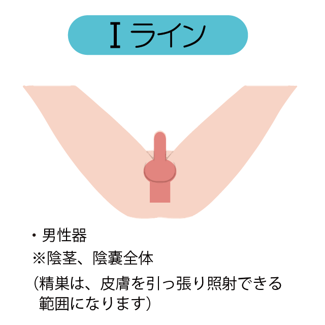 男性 Iライン